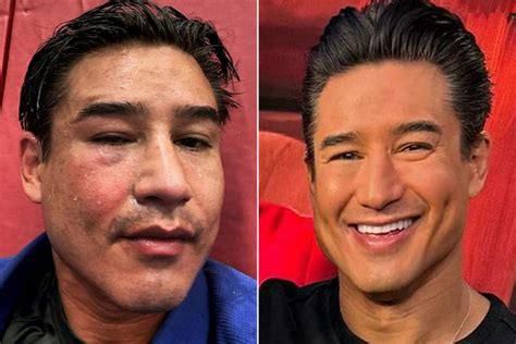 Holy Shit! What did Mario Lopez do to his face